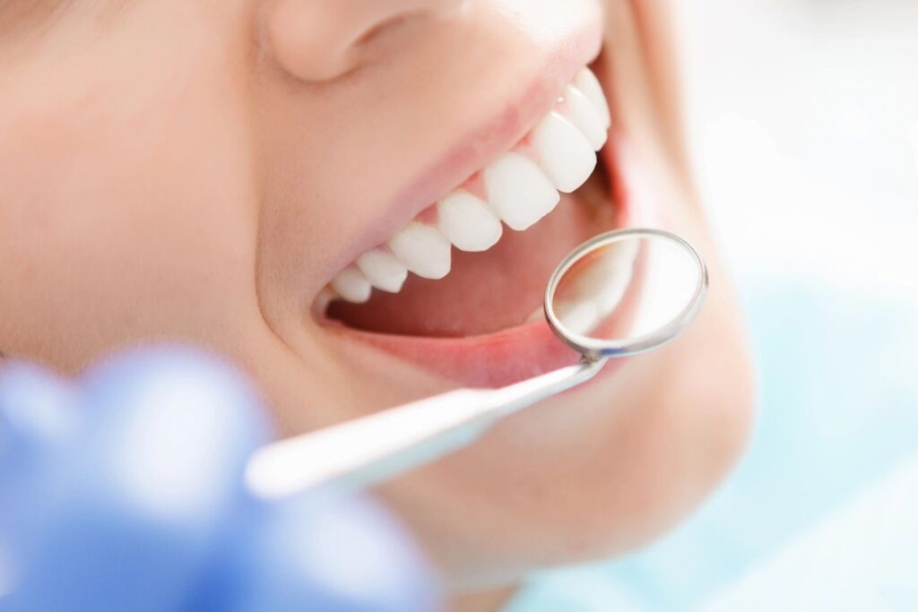 DENTAL INSURANCE